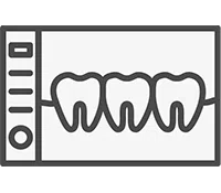 Implant Dentures